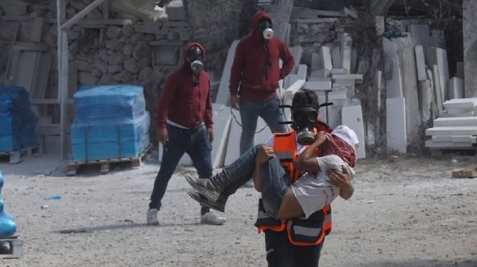 İ̇srail Askerlerinden Nablus’ta Filistinlilere Sert Müdahale: 217 Yaralı