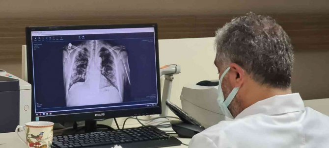 Covid-19 Hastalarında Uyguladıkları Tedavi Dünya Literatürüne Girdi