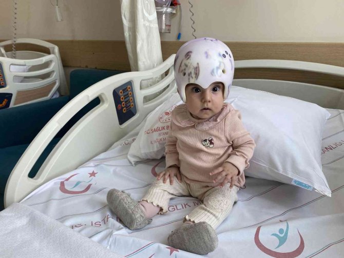 Bebeklerde Kafatası Şekil Bozukluğuna Dikkat!