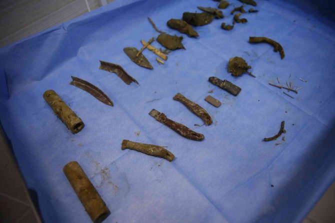 Deve Kuşu Midesinden Bıçak, Çivi, Çakmak, Plastik Boru Ve Çeşitli Yabancı Cisimler Çıkarıldı