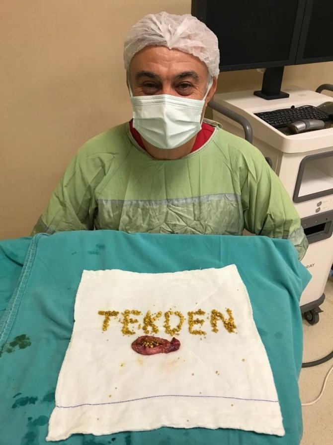 Safra Kesesi Ameliyatından Çıkan Yüzlerce Taşla Tekden Yazdı