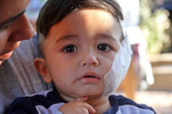 Antalya’da Baba Ve 11 Aylık Oğlunu Hastanelik Eden Pitbull Dehşeti