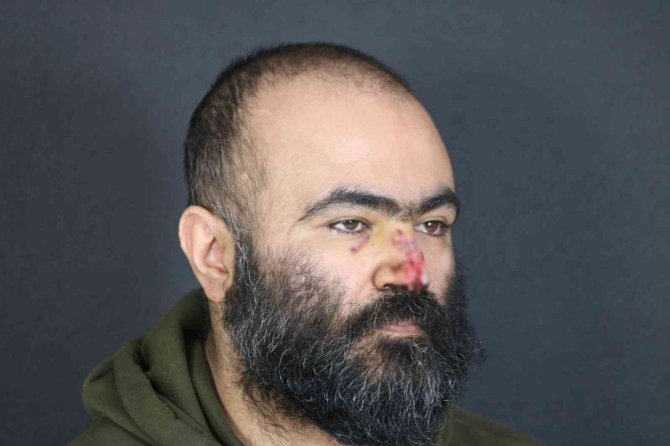 Pitbullun Kopardığı Buruna Estetik Yama