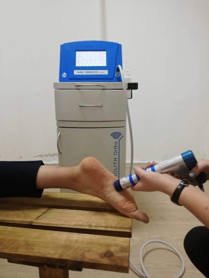 Topuk Dikenine Ameliyatsız Çözüm