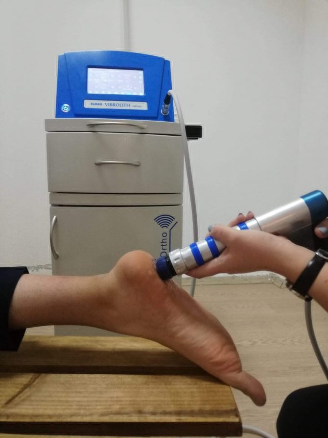 Topuk Dikenine Ameliyatsız Çözüm