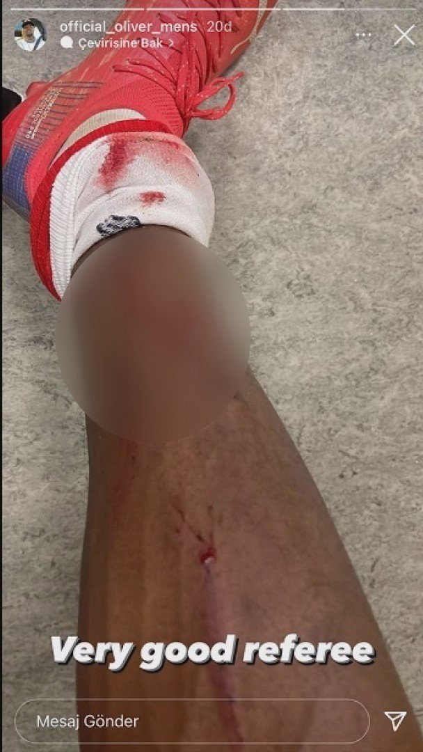 Bernard Mensah’tan Hakeme Tepki
