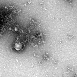 Rusya’da Korona Virüsün Delta Plus Mutasyonu Görüntülendi