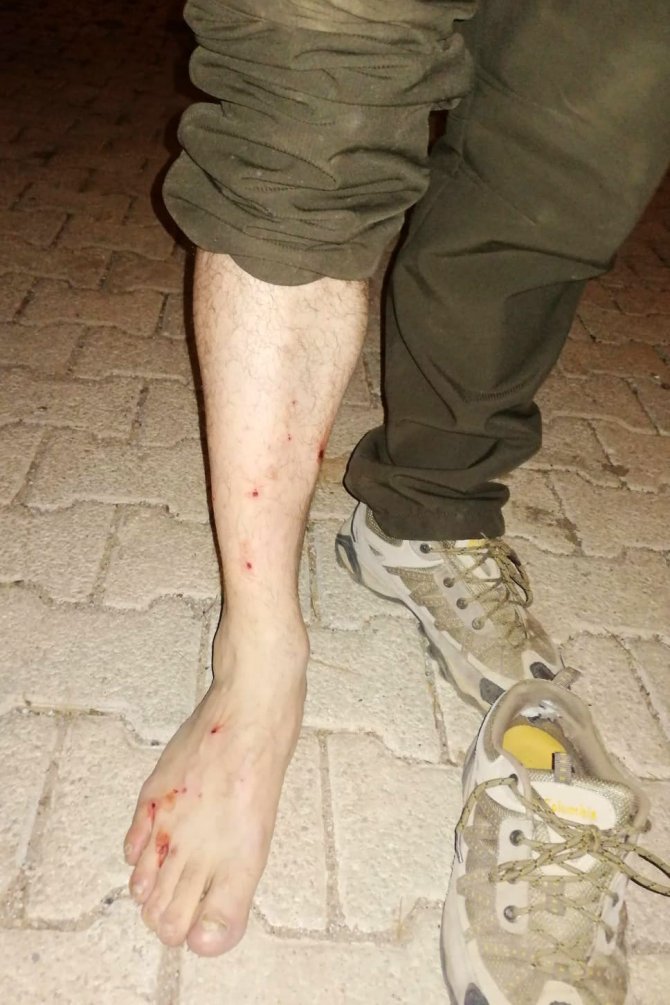 Kaçak Avcılar Av Koruma Memuruna Silahla Saldırdı