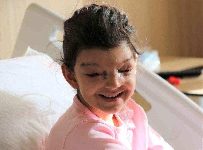 Gözlerinin Arasındaki Mesafe Normalden Daha Fazla Olan Minik Ayşenur Sağlığına Kavuştu