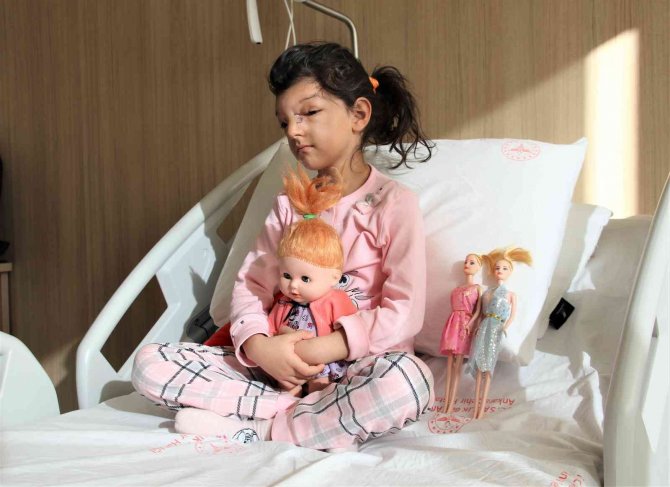 Gözlerinin Arasındaki Mesafe Normalden Daha Fazla Olan Minik Ayşenur Sağlığına Kavuştu