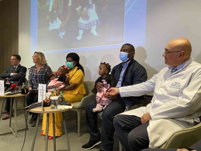 Kamerunlu Yapışık İkizler Türkiye’de Yeniden Doğdu