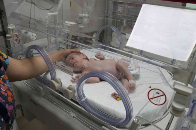 Açık Omurga İle Doğdu