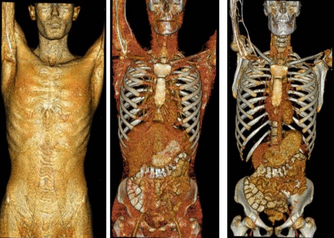 Tıbbın Gören Gözleri Ve Görünmeyen Emekçilerinin Günü