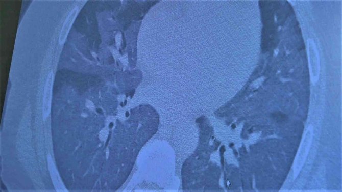 Prof. Dr. Özkaya: "Plazma Stoklarının Bittiğini Duyuyoruz, Mutlaka Kan Bağışında Bulunmalıyız"