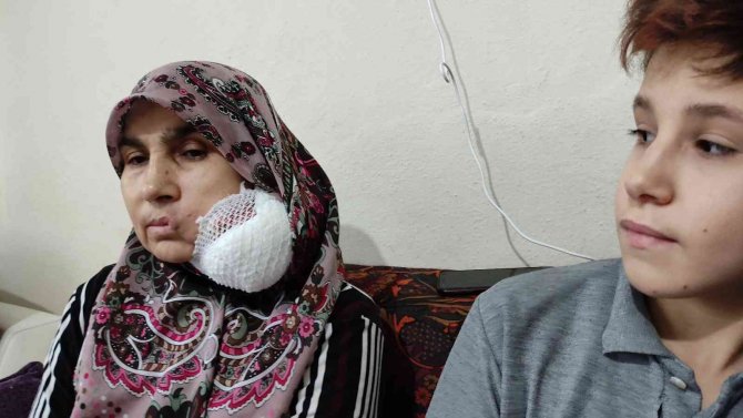 Yüzündeki Dev Kitleden Kurtulmak İçin Yardım Bekliyor