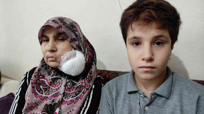 Yüzündeki Dev Kitleden Kurtulmak İçin Yardım Bekliyor