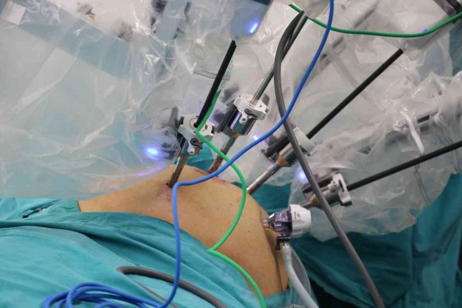 Bu Sistem Adeta Cerrahların Eli Kolu: “Robotik Cerrahi”