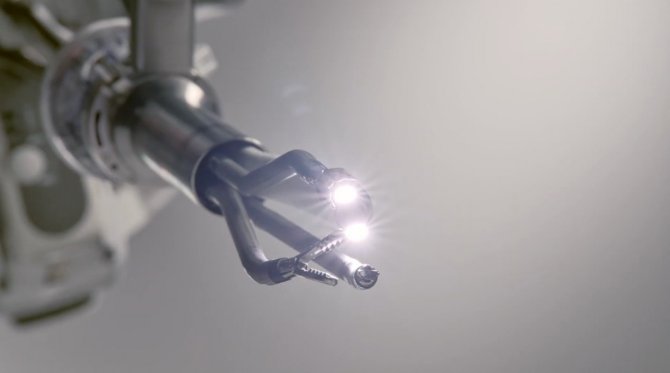 Robotik Cerrahi Teknolojisi Yenileniyor