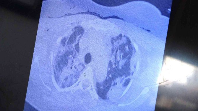 Prof. Dr. Özkaya: "Virüs Artık Akıllı Bir Organizma Gibi Davranıyor"