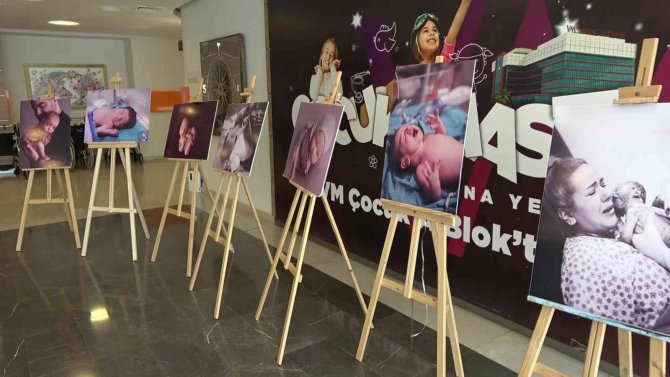 Bu Serginin Gözbebeği Prematüre Bebekler