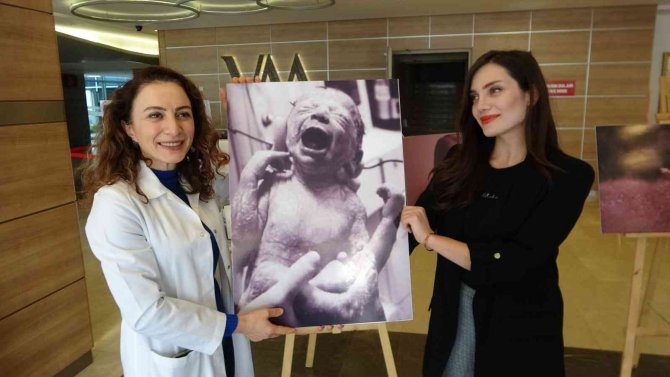 Bu Serginin Gözbebeği Prematüre Bebekler