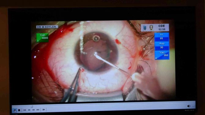 Van’da 5. Urartu Göz Günleri Semineri