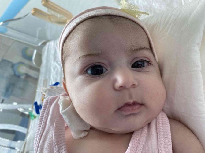 2 Aylık Ecrin Bebeğe Hayat Veren “Kalp” Ameliyatı