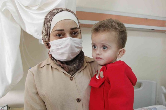 Velid Bebeğe Midesinden Yemek Borusu Yapıldı