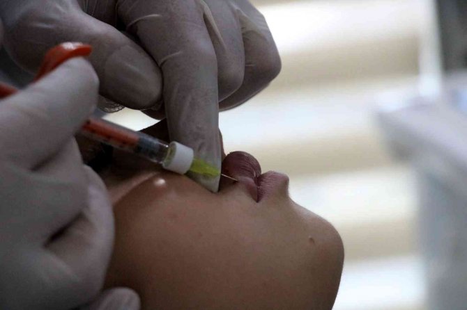 Yanlış Uygulanan Dudak Dolguları Körlüğe Yol Açabiliyor