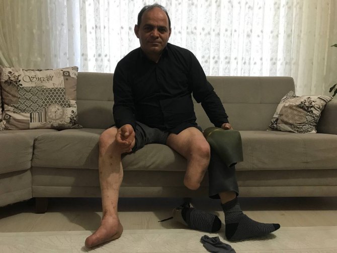 1995 Senesinde Mayına Basarak Bacağını Kaybeden Bayburtlu Gazi O Günleri Anlattı