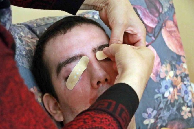 8 Yıldır Gözlerini Kırpamıyor, Adeta Kan Ağlıyor