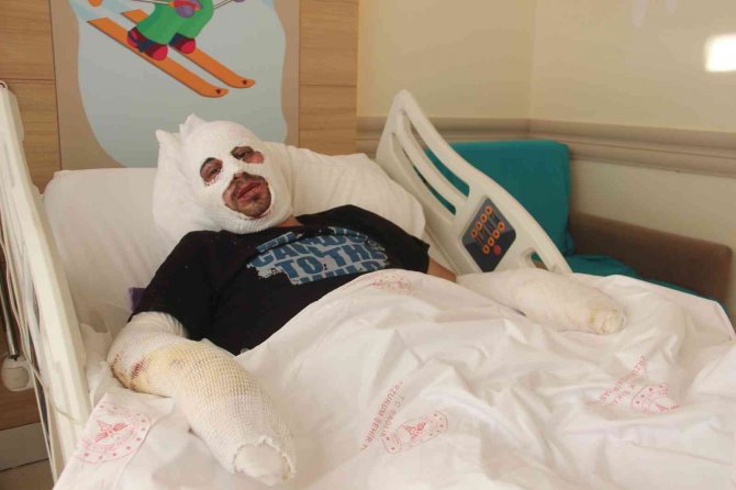 Kafe Yangınında Canını Zor Kurtardı