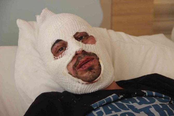 Kafe Yangınında Canını Zor Kurtardı