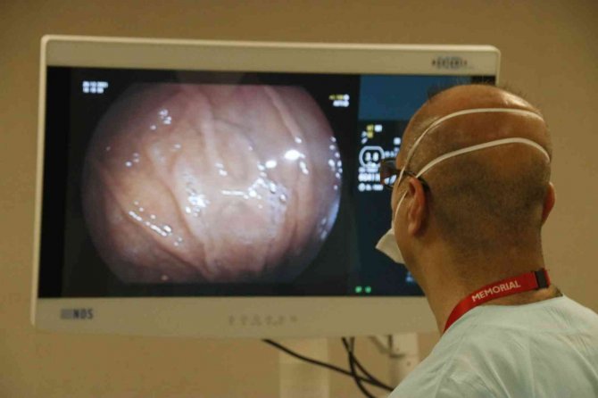 Mide Botoksunda 15 Dakikalık İşlemle Hastalar Rutin Yaşamlarına Devam Ediyor