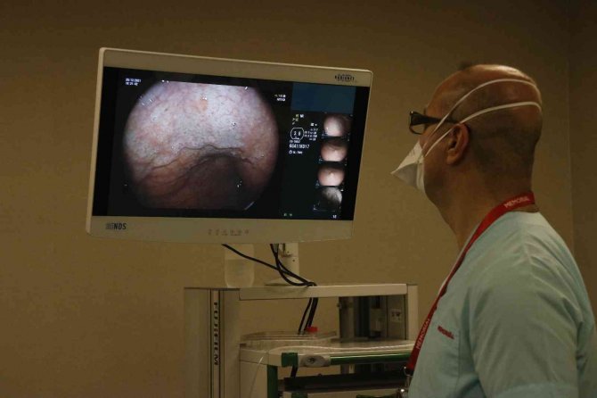 Mide Botoksunda 15 Dakikalık İşlemle Hastalar Rutin Yaşamlarına Devam Ediyor