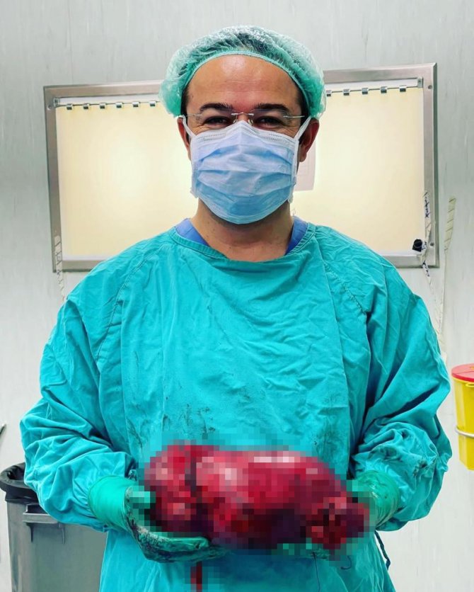 Korona Virüs Sayesinde 30 Santimlik Tümöründen Kurtuldu