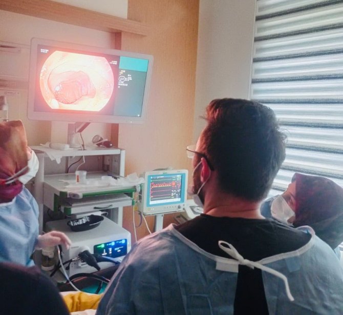 Ayancık’ta Endoskopi Ve Kolonoskopi İşlemleri Başladı