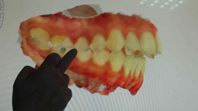 Van Yyü Diş Fakültesi Teknolojik Cihazlarla Bölge Halkına Hizmet Veriyor