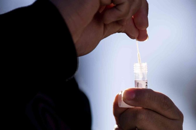 Abd’den Covid-19 Rekoru: 1 Milyon Vaka Tespit Edildi