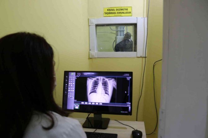 "Tüberküloz Tedavi Edilebilir Bir Hastalıktır"