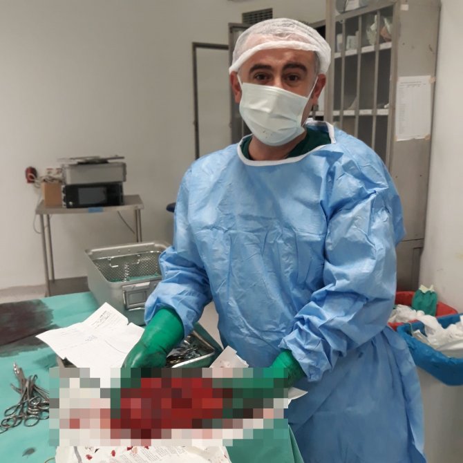 Böbreğinden 3 Kilogram Tümör Çıkarıldı