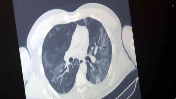 ’İ̇nfluenza’ Alarmı