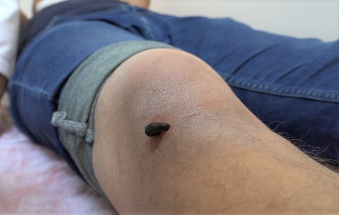 Doktor Sülükler Şifa Kaynağı