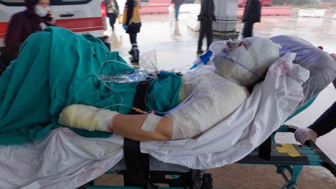 Boşandığı Karısını Yanıcı Madde Dökerek Yaktı