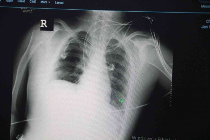 Uzmanlar, Kovid-19’un Birkaç Ay İçerisinde Biteceğini Öngörüyor