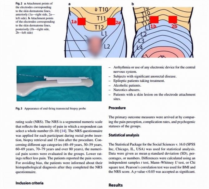 Türk Doktor Keşfetti, Prostat Biyopsisi Kabus Olmaktan Çıktı