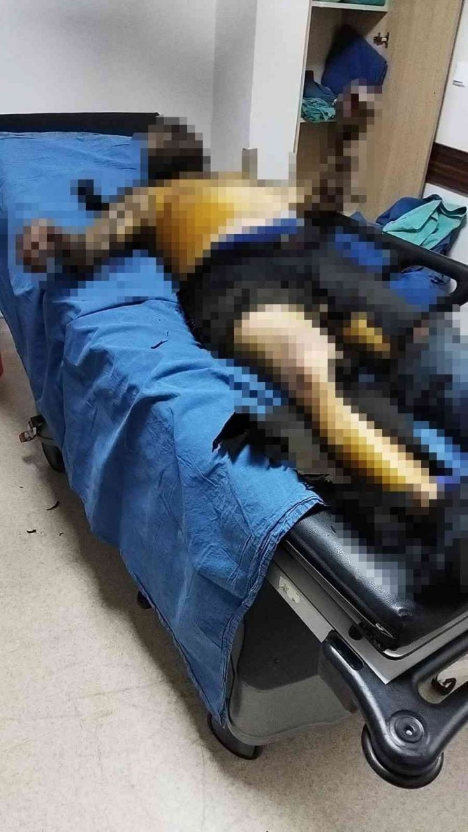 Marmaris’te Kendini Yakan Kömürcü Hayatını Kaybetti