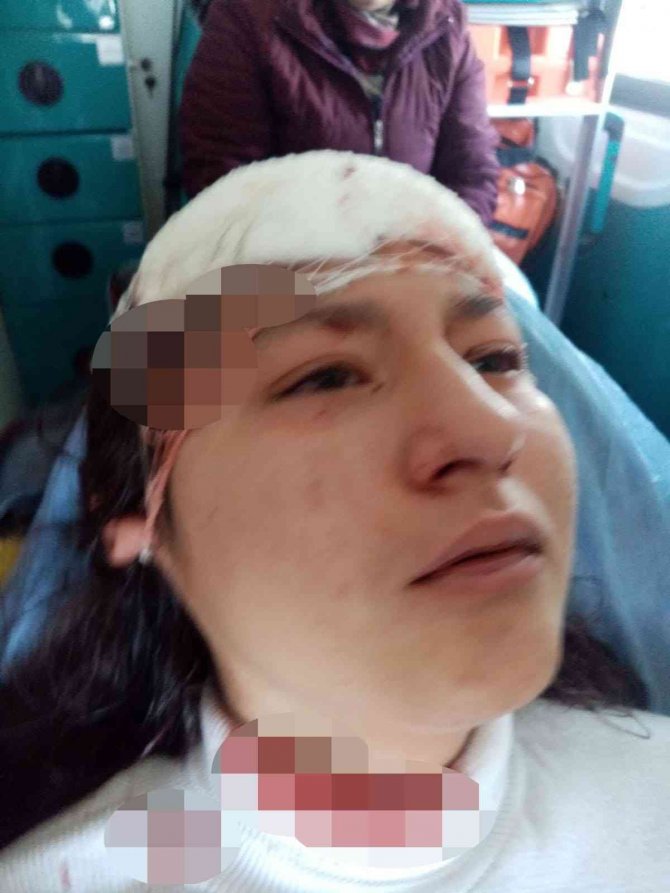 Öz Çekim Yaparken Sokak Köpeklerinin Saldırısına Uğrayan Çocuk Ölümden Döndü