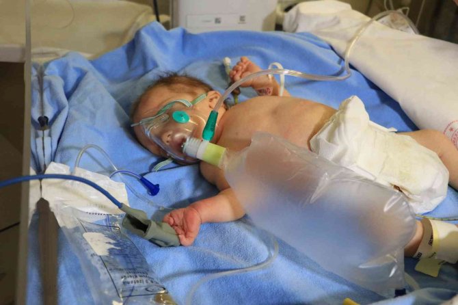 Ambulans Helikopterle Adana’ya Getirilen Minik Ahmet’in Durumu İyi