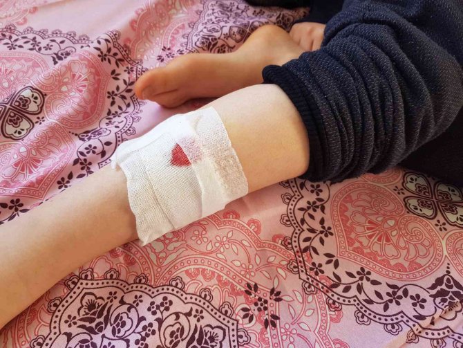 Sokak Köpekleri Bir Çocuğa Daha Saldırdı